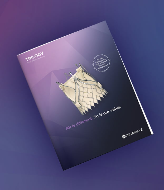 Trilogy System illustration