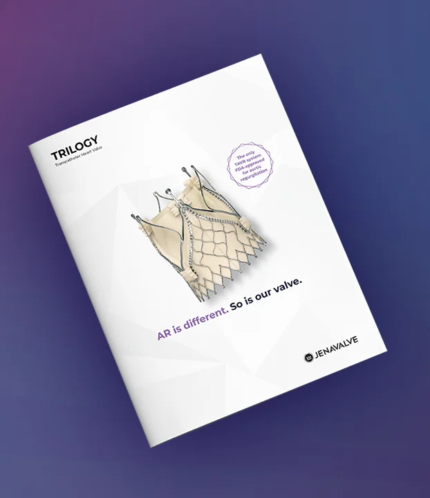 Trilogy System illustration