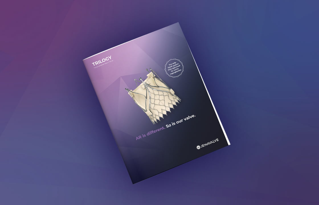 Trilogy System illustration