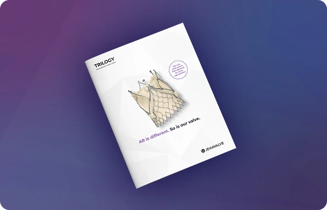 Trilogy System illustration