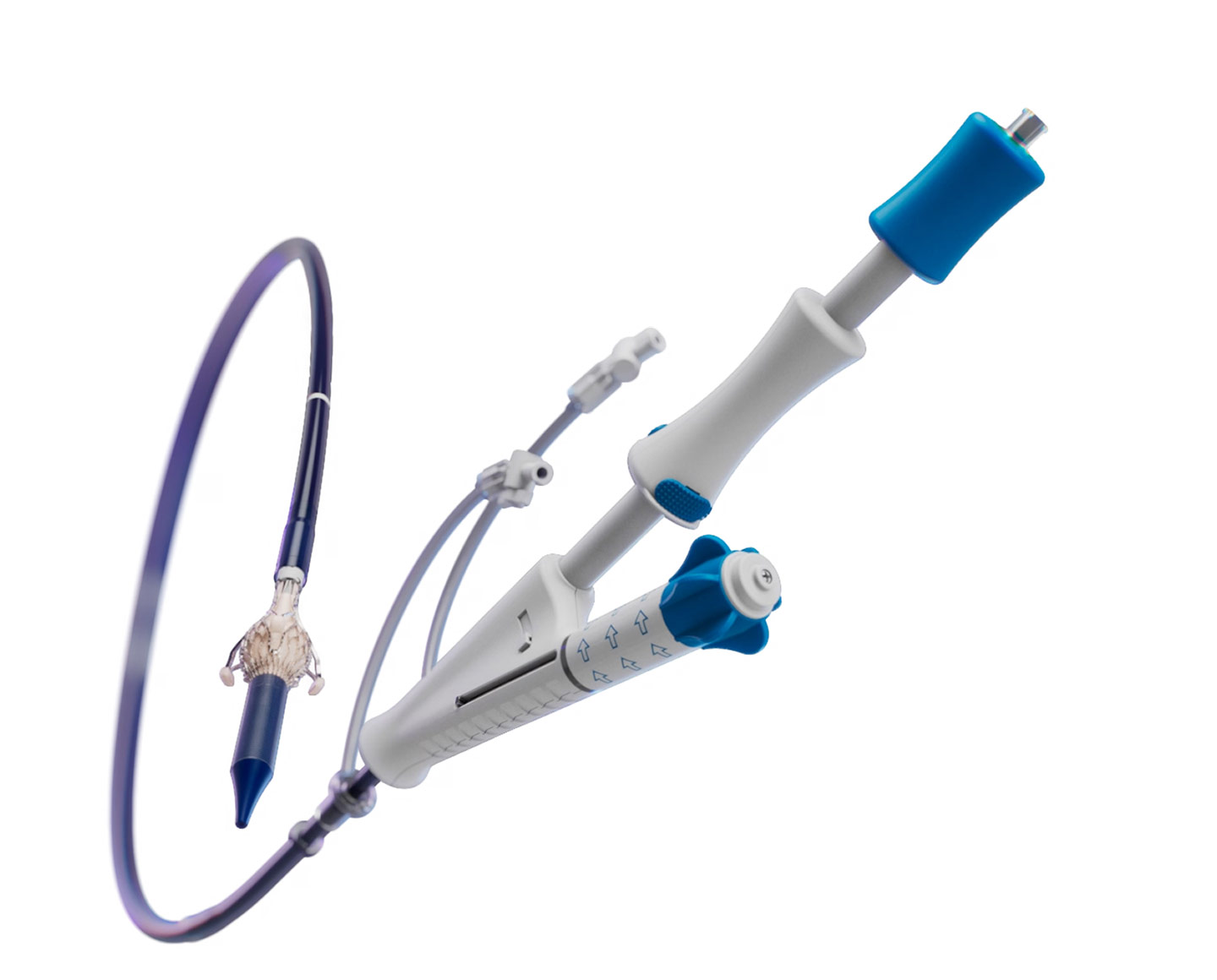 Trilogy Delivery System